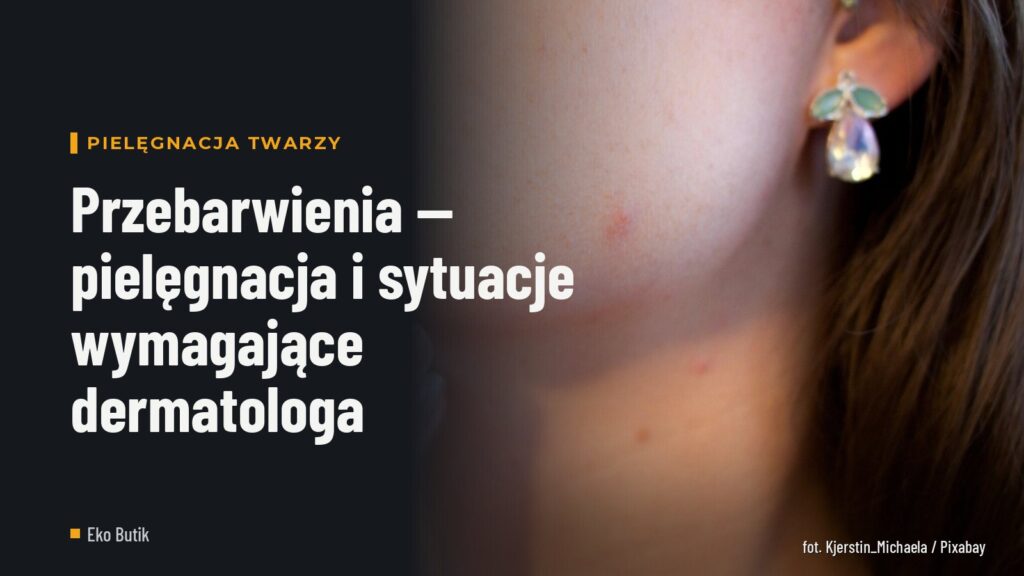 Przebarwienia — pielęgnacja i sytuacje wymagające dermatologa